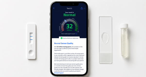 ExSeed home sperm test: app showing a Normal result of 32 million total motile sperm count
